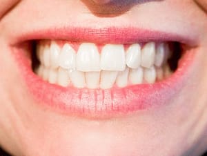 teeth 
